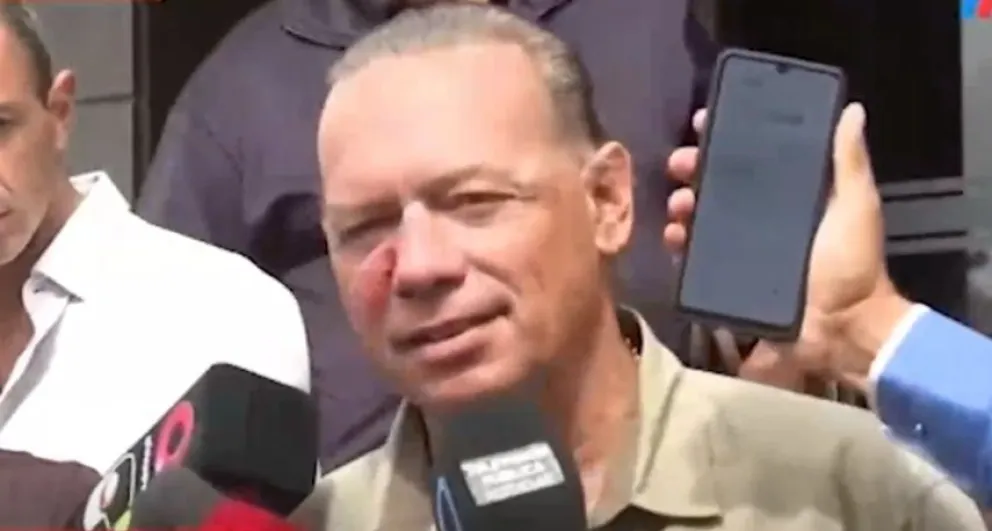 Tras ser agredido en una protesta, Berni confirmó que seguirá al frente de la seguridad en la Provincia