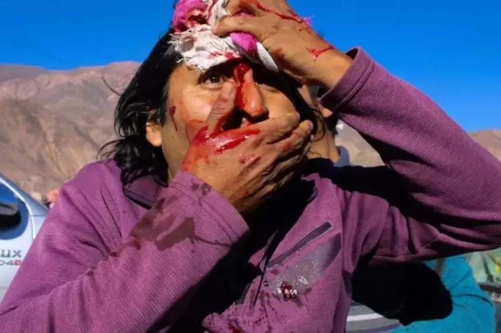 Piden a dirigentes políticos de la oposición local que se expresen en torno a la represión en Jujuy